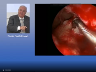 Introduction of VITOM 3D system