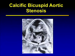 Introduction to common congenital cardiac lesions