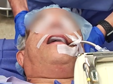 Introduction to Laryngology Room Set up & Ergonomics