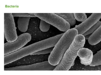 Introduction to Microbiology: Microbes & Bacteria _ Microbiology_ Lecturio