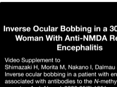 Inverse Ocular Bobbing in a 30-Year-Old Woman With Anti-NMDA Receptor Encephalitis Inverse Ocular Bobbing in a 30-Year-Old Woman With Anti-NMDA Receptor Encephalitis
