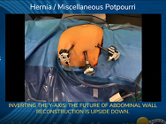 INVERTING THE Y-AXIS: THE FUTURE OF ABDOMINAL WALL RECONSTRUCTION IS UPSIDE DOWN INVERTING THE Y-AXIS: THE FUTURE OF ABDOMINAL WALL RECONSTRUCTION IS UPSIDE DOWN