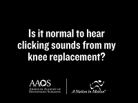 Is it normal to hear clicking sounds from my knee replacement? Is it normal to hear clicking sounds from my knee replacement?