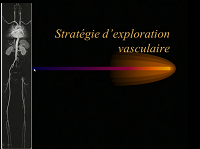 Ischémie du membre inférieur : cas radio-cliniques