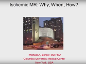 Ischaemic MR: why, when, how? Ischaemic MR: why, when, how?