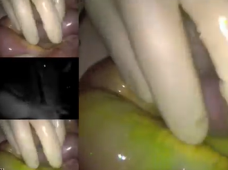 Ischemic and Injured Bowel Evaluation with PINPOINT Fluorescence Imaging