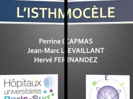 Isthmocèle : de l'image a la therapeutique Isthmocèle : de l'image a la therapeutique