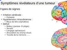 Journée des aidants : Neurochirurgie et tumeurs cérébrales