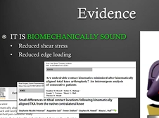 KA Tibial Cut Is Safe