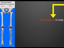 KA-TKA: Patella Resurfacing or Not? - Rational & Evidence