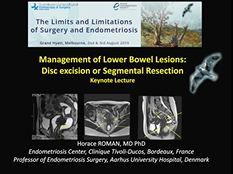 Keynote at the Congress of Australian Gyn Endoscopy and Surgery & World Endometriosis Soc Keynote at the Congress of Australian Gyn Endoscopy and Surgery & World Endometriosis Soc