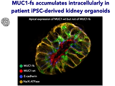 Kidney Week 2020 Reimagined: Plenary: Donald W. Seldin Young Investigator Award, State-of-the-Art Kidney Week 2020 Reimagined: Plenary: Donald W. Seldin Young Investigator Award, State-of-the-Art