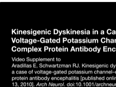 Kinesigenic Dyskinesia in a Case of Voltage-Gated Potassium ChannelComplex Protein Antibody Encepha Kinesigenic Dyskinesia in a Case of Voltage-Gated Potassium ChannelComplex Protein Antibody Encepha