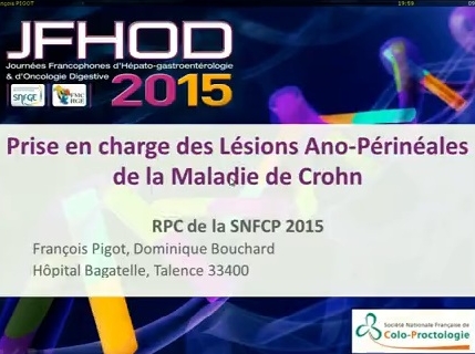 Lésions ano-périnéales de Crohn : recommandations de la SNFCP