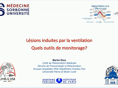 Lésions induites par la ventilation mécanique