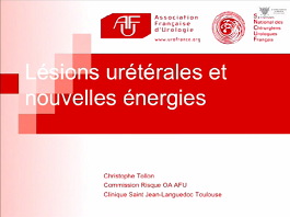 Lésions urétérales et nouvelles énergies