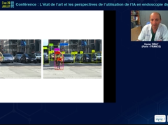 L'état de l'art et les perspectives de l'utilisation de l'IA en endoscopie digestive L'état de l'art et les perspectives de l'utilisation de l'IA en endoscopie digestive
