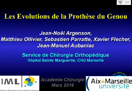 L'évolution de la prothèse totale du genou