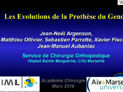 L'évolution de la prothèse totale du genou