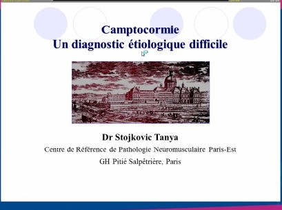 La camptocormie dans le cadre des affections neuromusculaires : diagnostic et prise en charge La camptocormie dans le cadre des affections neuromusculaires : diagnostic et prise en charge