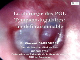 La chirurgie des paragangliomes tympano-jugulaire : un défi raisonné