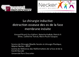 La chirurgie inductive : distraction chirurgicale des os de la face - Membranes induites La chirurgie inductive : distraction chirurgicale des os de la face - Membranes induites