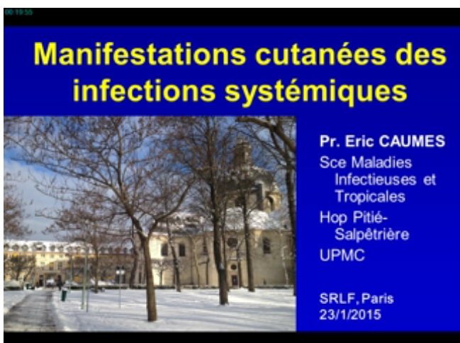 La Dermatologie entre urgences et réanimation - Manifestations cutanées des infections systémiques - 2015