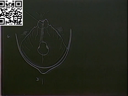 La fosse cérébrale postérieure I - Le cadre ostéologique