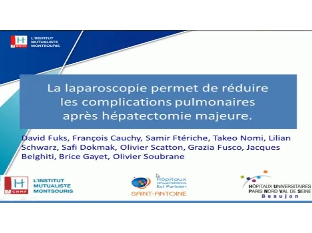 La laparoscopie permet de réduire les complications pulmonaires après hépatectomie majeure : analyse avec score de propension