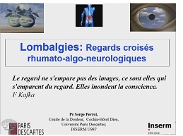 La lombalgie : regards croisés neuro-rhumatologiques