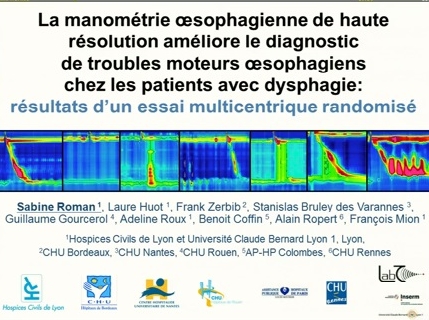 La manométrie œsophagienne de haute résolution améliore le diagnostic de troubles moteurs œsophagiens chez les patients avec dysphagie : résultats d’un essai multicentrique randomisé