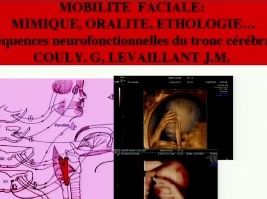 La mobilité faciale : qu'est-ce qu'une face immobile, dans quels cas rechercher ce signe? La mobilité faciale : qu'est-ce qu'une face immobile, dans quels cas rechercher ce signe?