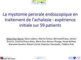 La myotomie perorale endoscopique en traitement de l'achalasie : expérience initiale sur 59 patients La myotomie perorale endoscopique en traitement de l'achalasie : expérience initiale sur 59 patients