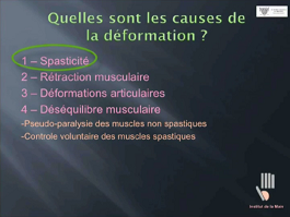 La neurectomie sélective dans le traitement de la spasticité