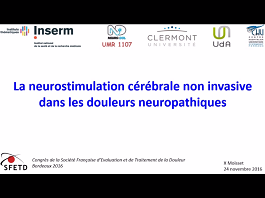 La neurostimulation cérébrale non invasive dans les douleurs neuropathiques La neurostimulation cérébrale non invasive dans les douleurs neuropathiques