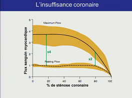 La Perfusion myocardique