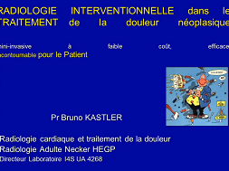La place de l'imagerie interventionnelle dans la prise en charge des patients atteints de cancer