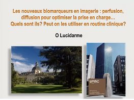 La place des techniques d'imagerie avancée (hors TEP)