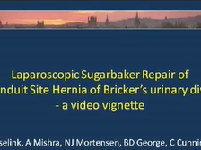 Laparoscopic Modified Sugarbaker Technique for the Repair of an Urostomal Hernia - a Video Vignette Laparoscopic Modified Sugarbaker Technique for the Repair of an Urostomal Hernia - a Video Vignette