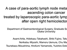 Laparoscopic para-aortic lymphadenectomy after multiple previous abdominal surgeries Laparoscopic para-aortic lymphadenectomy after multiple previous abdominal surgeries