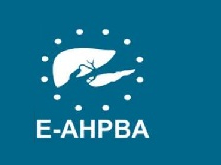 Laparoscopic Partial Sleeve Duodenectomy (PSD) for Duodenal Adenoma