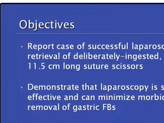 Laparoscopic Removal Of Ingested Gastric Foreign Body