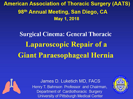 Laparoscopic Repair of a Giant Paraesophageal Hernia