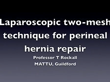 Laparoscopic Repair of Post-Operative Perineal Hernia Using a Two-Mesh Technique Laparoscopic Repair of Post-Operative Perineal Hernia Using a Two-Mesh Technique
