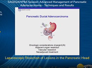 Laparoscopic Resection of Lesions in the Pancreatic Head