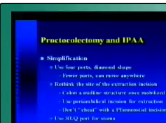 Laparoscopic restorative proctocolectomy Laparoscopic restorative proctocolectomy