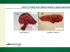 Laparoscopy in Colorectal Cancer