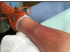 Large Abscess or Infection? Inside the Emergency Room with Dr ER