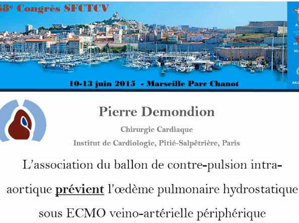 L'association du ballon de contre pulsion intra aortique prévient l'oedème pulmonaire hydrostatique L'association du ballon de contre pulsion intra aortique prévient l'oedème pulmonaire hydrostatique