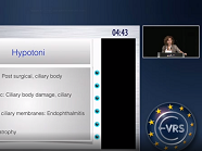 Last Chance for Treatment of Hypotony
